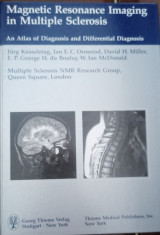 Magnetic Resonance Imaging in Multiple Sclerosis