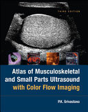 Atlas Of Musculoskeletal and Small Parts Ultrasound with Color Flow Imaging