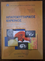 Ηπατοκυτταρικός καρκίνος