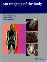 MR Imaging of the Body