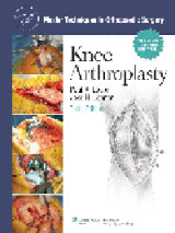 Master Techniques in Orthopaedic Surgery Series: Knee Arthroplasty, 3rd ed.