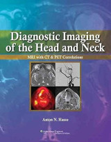 Diagnostic Imaging of the Head and Neck: MRI with CT & PET Correlations